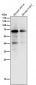 Anti-Estrogen Receptor alpha Rabbit Monoclonal Antibody